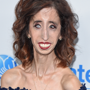 Lizzie Velasquez