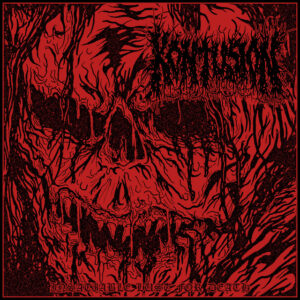 Kontusion